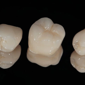 Three dental crowns sitting on a reflective surface